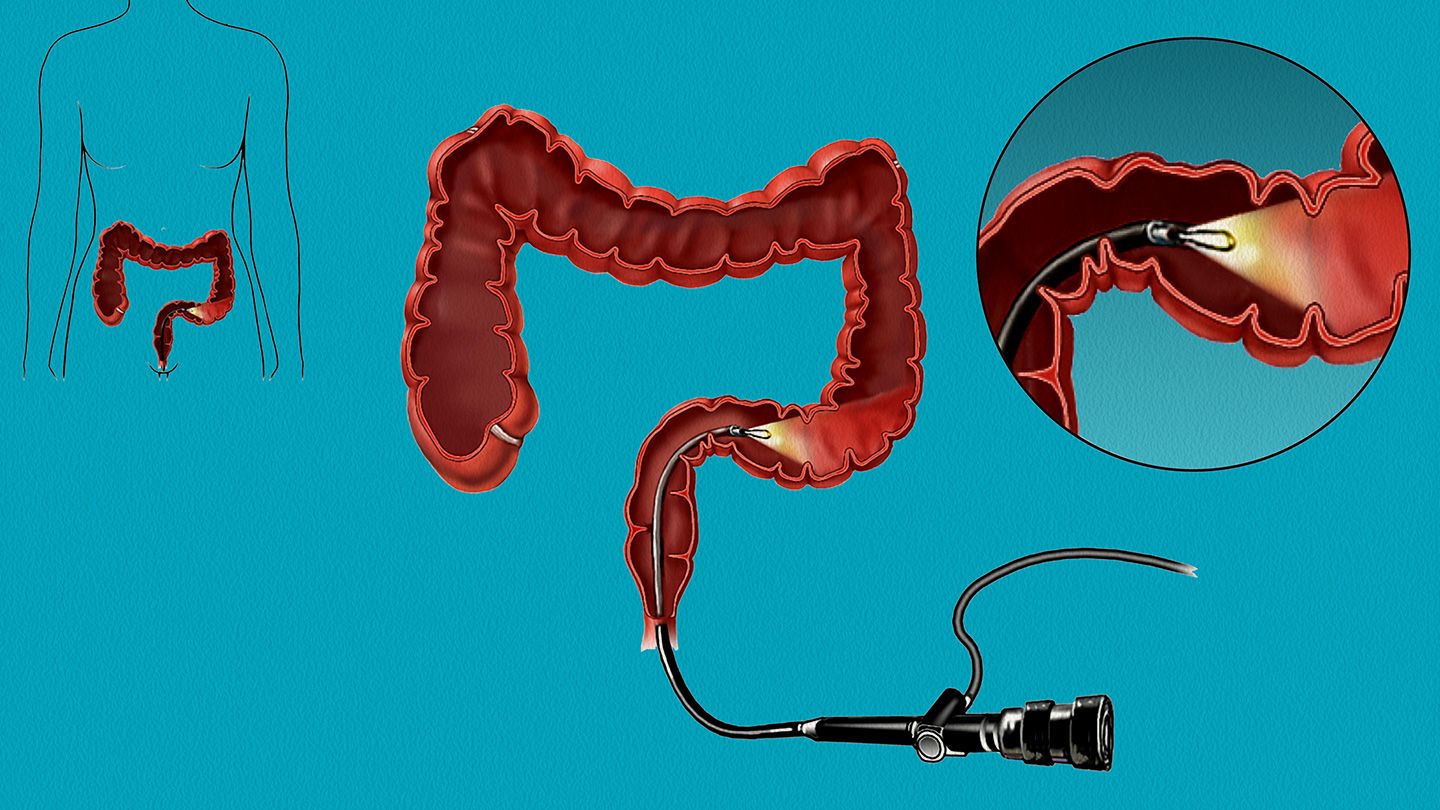 Experienced Endoscopy Doctor in Noida