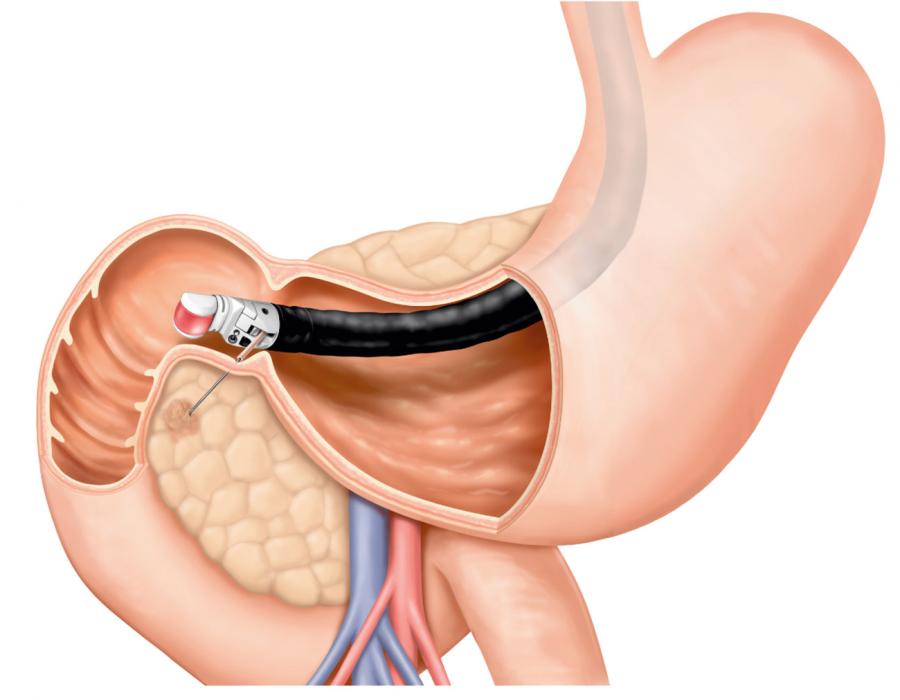 Advanced Endoscopy Specialist in Noida