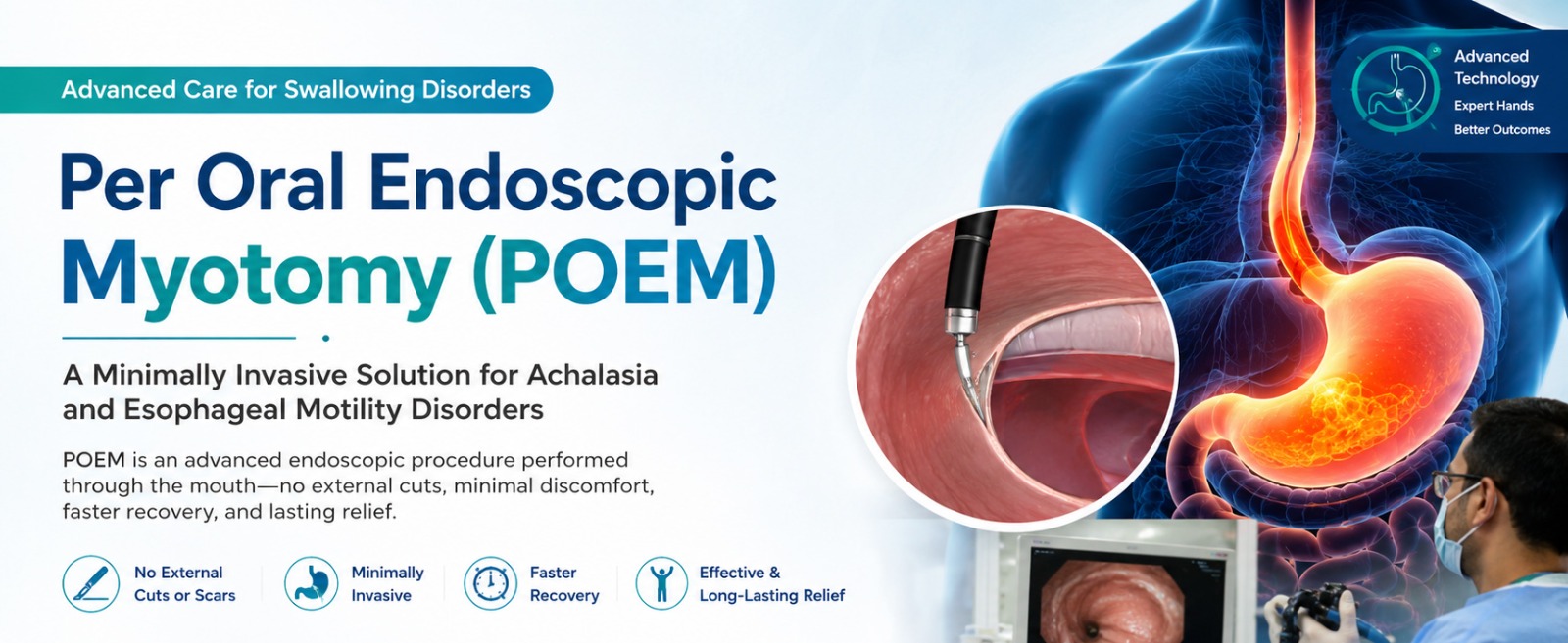 Per Oral Endoscopic Myotomy (POEM) in Noida